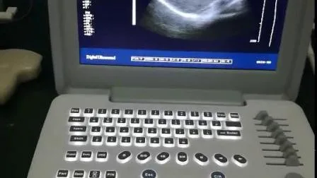 Scanner de ultrassom portátil digital B/W hospitalar para ginecologia ginecológica