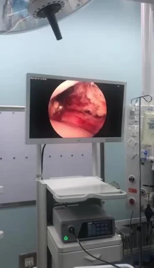 Instrumento laparoscópico de equipamento médico de endoscópio laparoscópico